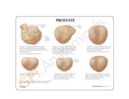 MODEL PROSTATE NORMAL 5 CONDITIONS