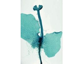 FERN PROTHALLIUMYOUNGSPOROPHYTE(WM)FS&FG