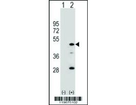 AADAC ANTIBODY (C-TERM)