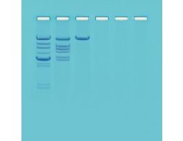 KT ANAL OF RESTRICTION ENZYME CLEVAGE