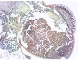INSECT COMPOUND EYE (SECT) MAS RADIAL