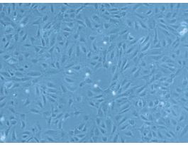 HUVEC SINGLE DONOR PELLET