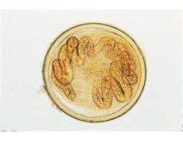 PARAGONIMUS WESTERMANIMETACERCARIA(WM)