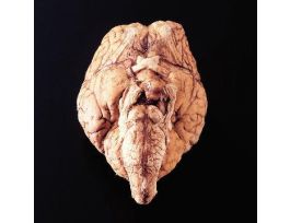 FREEZE-DRIED BRAINS PKG/10 PRESERVED