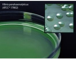 MEDIUM TCBS AGAR PLATED F/VIBRIO PK10