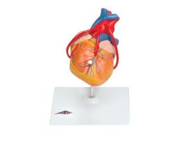 MODEL GIANT HEART W/ BYPASS