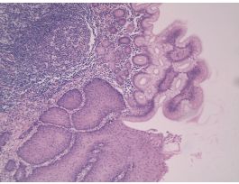 ESOPHAGUS/STOMACH JUNCTION H&E(PRIMATE)