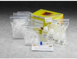 VIRAL ACID EXTRACTION KIT