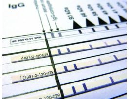 KIT B.BURGDORFERI IGG LINE BLOT 50 TEST