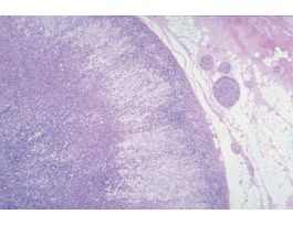 ADRENAL GLAND (SECT) H&E M SUPEARENAL