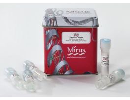 TRANSIT-X2DYNAMIC SYSTEM 1500UL PK5