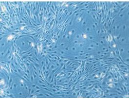 HDMEC-c: Human Dermal Microvascular Endothelial Cells (HDMEC) juvenile foreskin