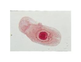 HYMENOLEPIS SP.-CYSTICERCOID (WM) SLIDE
