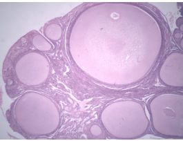CHICKEN OVARY (SECT) H&E DEVELOPING OVA