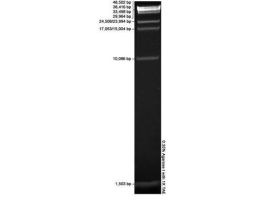 DNA MW MARKER HIGH RNG BIOTECH GR 150UG