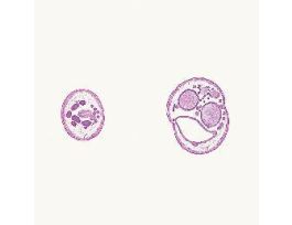 ASCARIS MALE & FEMALE CS WARDS ITEM