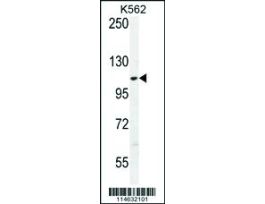 AARS2 ANTIBODY (CENTER)