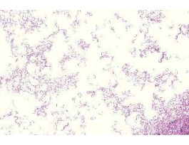 METACHROMATIC GRANULES (SM) AS SLIDE