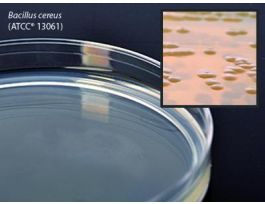 MEDIUM STRH AGAR 15X100MM PLTD 18ML PK10