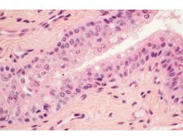 INTESTINE (MAMMALIAN) SECT