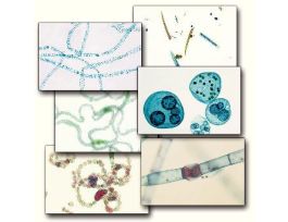 ALGAE SURVEY SLIDE SET 15/ST WL30785