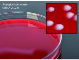 PLATE COLUMBIA BLOOD AGAR 15X100MM CS100