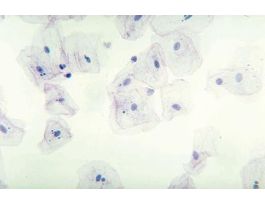 EPITHELIUM (HUMAN) SQUAMOUS SM OF