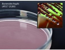 MEDIUM BBE AGAR PLTD F/ANAEROBE PK10