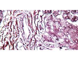 RETICULUM CHANDLER'S KT 100RXN