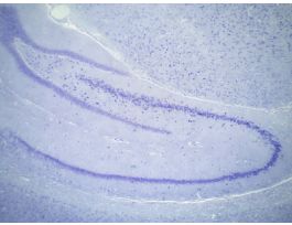 HYPOTHALAMUS (CS) CV M SHOWING 3RD