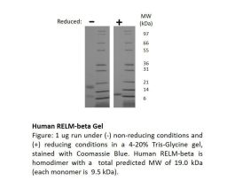 100-160AF-25UG HUMAN RELM-BETA (AF)