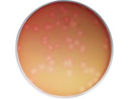 EXPLORING THE BACTERIOPHAGE LIFE CYCLE