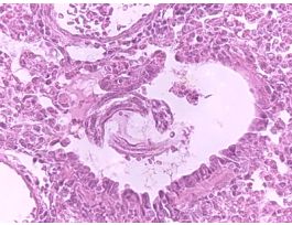 ASCARIS LUMBRICOIDES-LARVAE ( ) H&E