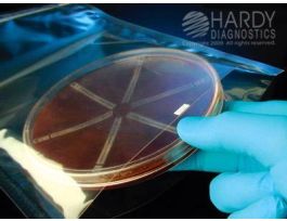 PLATE-BAG ANABAG 150MM PK20