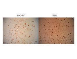 AMYLOID ANTIBODY 100UL