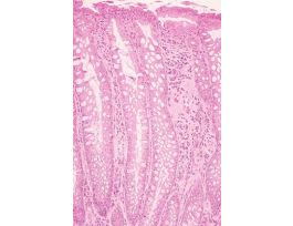 COLON (CS) 1.5UM H&E SLIDE(MAMMAL)