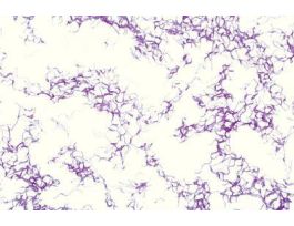 AQUASPIRILLUM SERPENS G (-)FOUND IN POND