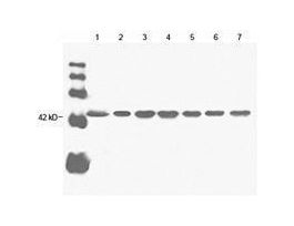 (THETM BETA ACTIN ANTIBOD MAB MOUSE)
