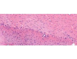 INVOLUNTARY (SMOOTH) MUSCLE (MAMMALIAN)