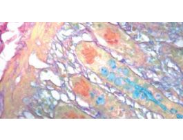 COLLOIDAL IRON KIT 100RXN