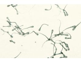 BULL SPERM (SM) IH SLIDE