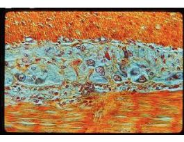 AUERBACH'S PLEXUS (SECT) A M FROM