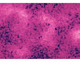 FD STREPTOCOCCUS PNEUMONIAE W/MEDIA