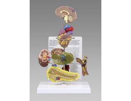 MODEL METABOLIC SYNDROME