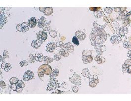 FORAMINIFERA SHELLS MIXED