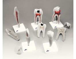 MODEL CLASSIC TOOTH SERIES