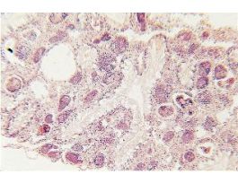 SCHISTOSOMA MANSONI- SPOROCYSTS H&T