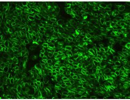 DYLIGHT488 GOAT ANTI RABBIT IGG