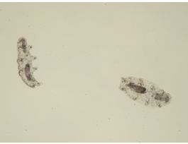 HYPSIBIUS (WATER BEAR)PHYLUM TARDIGRADA.