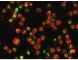 KIT NUCVIEW488-MITOVIEW633 APOP 100ASS